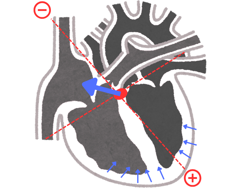Ventricular repolarization and QRS vector direction (formation of T wave)